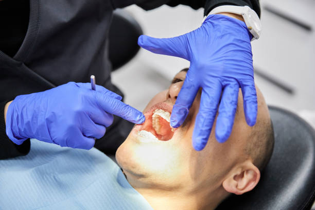 Best Emergency Dental Extractions in Mabton, WA